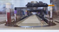 Chaos s testovaním na nový koronavírus. Niektorí naň čakali aj desať dní