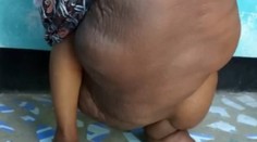 Na ženu s chorou gigantickou nohou sa usmialo šťastie