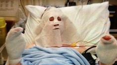 Chlapec dokazoval spolužiakom, že dokáže založiť oheň. Takmer zhorel