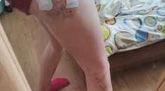 Dráma v Prievidzi. Pes dohrýzol tehotnú mamičku, ktorá pred ním chránila dcéru