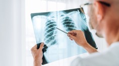 Vedci pomocou novej techniky prišli na to, že covid spôsobuje skryté poškodenia pľúc