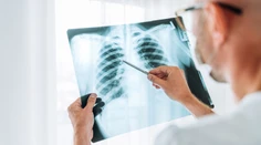 Vedci pomocou novej techniky prišli na to, že covid spôsobuje skryté poškodenia pľúc