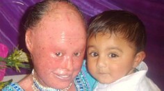 Podľa lekárov mala zomrieť krátko po narodení. Dnes je z nej dospelá žena