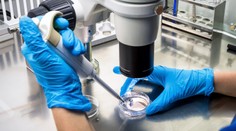 Nespôsobuje rakovinu, no významne pomáha jej šíreniu. Vedci opísali mechanizmus, ako stres pomáha šíreniu metastáz