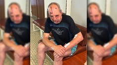 Medvedica sa mužovi v Kremnických vrchoch zahryzla do čela. V nemocnici nám opísal útok