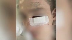 V Prešove vyčíňali bitkári: Prvá obeť skončila na operačnom stole, tým sa to však neskončilo