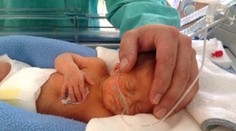 Miško sa narodil predčasne a trápia ho zdravotné problémy. Je to malý bojovník