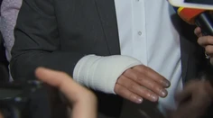 Richard Sulík objasnil, ako sa zranil