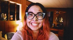 Andrea trpí vzácnou chorobou, ktorá ničí jej kožu. Lekári jej už 28-krát diagnostikovali rakovinu