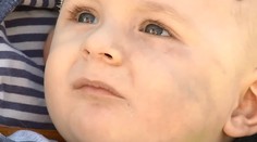 Adamka mali zbiť v súkromných jasliach. Matka pôjde na detektor lži