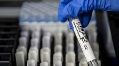 Prečo má koronavírus u niekoho ťažký priebeh? Vedci naznačili príčinu v týchto štúdiách