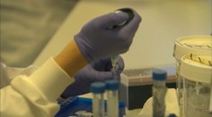 Slovenskí vedci objavili nový proteín, ktorý opravuje poškodenú DNA