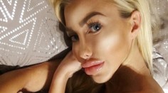 Nechutná poľská Barbie: Nohy ako palice, vysekaná sánka a pery cez pol tváre