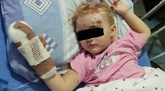 Stav Mišky (4) sa po nehode zlepšil. Opitý vodič, ktorý ju zrazil, má plný register trestov