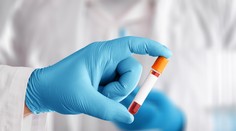 Na prahu revolúcie v medicíne: Krvný test, ktorý rozpozná 50 druhov rakoviny, má sľubné výsledky