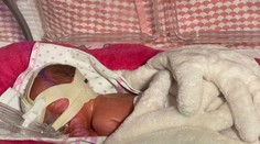 Trojnásobná radosť v Martine. Ukrajinka v nemocnici porodila trojičky