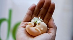 Sú Slováci za sprísnenie pravidiel potratov? Na telo prináša exkluzívny prieskum