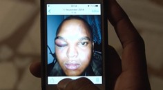 Kotlebov poslanec má problém. Takto mal dobiť muža tmavej pleti