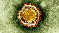 Šesť filipínskych zdravotníkov sa nakazilo koronavírusom MERS, jeden zomrel