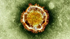 Šesť filipínskych zdravotníkov sa nakazilo koronavírusom MERS, jeden zomrel