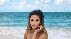 FOTO: Zuzana Plačková prvýkrát ukázala zmenšené prsia