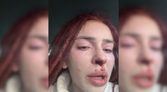 Týraná influencerka Ráchel prehovorila. Z prístupu polície je sklamaná