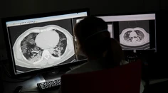 Desiatky zamestnancov nemocnice v Ružomberku sú v izolácii, prišli do styku s nakazeným pacientom