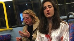 Nechceli si dať na povel v autobuse pusu, tak ich dobili päsťami. Útočníci mali iba do 18 rokov