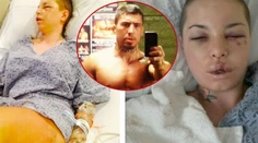 Množstvo zlomenín a prasknutá pečeň! Takto doriadil pornohviezdu profesionálny zápasník