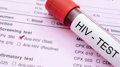 V Česku sa zvýšil počet nositeľov vírusu HIV, polícia vyšetruje zámerné šírenie