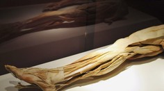 KDH žiada zrušiť výstavu skutočných ľudských tiel v Bratislave