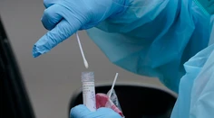 Za nedeľu pribudlo 3 503 nových pozitívnych, ochorenie si vyžiadalo ďalších 32 úmrtí