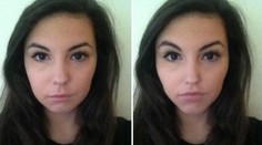 Ako by ste vyzerali po plastike? Pozrite sa!