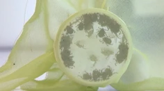 Desiatky ľudí sa v Košiciach sa nakazili encefalitídou, pôvodca zostáva neznámy