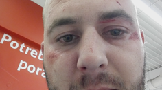 Cesta na nákup sa skončila surovou bitkou. Muža zbili pred jeho manželkou