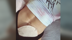 Mladé dievča trpí vážnou chorobou. Šíri osvetu o živote s vývodom