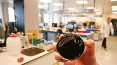 Talianov vystrašila epidémia legionárskej choroby, hlásia aj mŕtvych. Ako je na tom Slovensko?