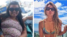 Z bacuľky modelkou! Po schudnutí však zostala Thayne zjazvená koža