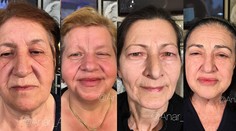 Vizážista dokáže zázraky. Pozrite, ako vyzerajú tieto ženy po nalíčení