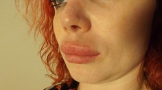 Prasací nos a desivá pera.Takto dokaličili Írku v Prahe