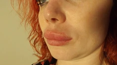 Prasací nos a desivá pera.Takto dokaličili Írku v Prahe