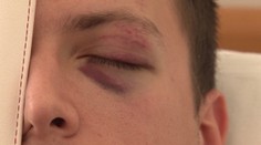 Policajtov privolali k hádke. Poriadne to schytali