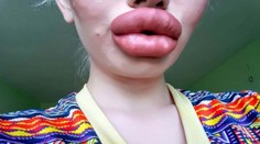 Dievča chcelo byť viac trendy. Dnes má také veľké pery, že ich nevie spojiť