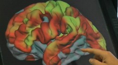 Americkým diplomatom, ktorí pôsobili na Kube, zistili zmeny v mozgu