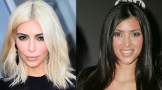 Kim má len 30, ale už má preplastikovanú celú tvár!
