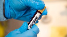 Pribudlo len 28 ľudí s potvrdeným koronavírusom, zomreli však ďalší šiesti pacienti