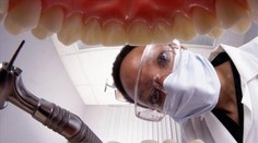 Bielenie zubov nebude už také, aké bývalo