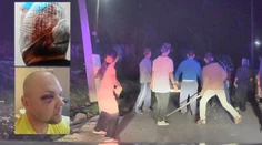 Agresivita v osadách stúpa. Takto dopadli napadnutí policajti