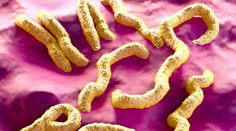 V západnej Afrike sa objavil nebezpečný vírus. Môže mať smrtnosť až 88 percent