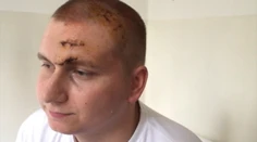 Pacient takmer zomrel pre nesprávne určenú diagnózu, zachránila ho mama